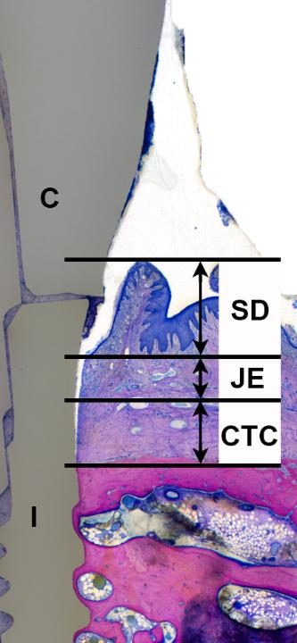 Fig. 3: Biologic width dimensions around a 2-piece zirconia dental implant. SD: sulcus depth; JE: junctional epithelium, CTC: connective tissue contact; I: zirconia implant; C: zirconia crown. Undecalcified, ground and polished methylmethacrylate-section stained with Giemsa-Eosin