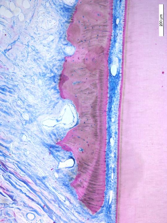 Fig. 17: Magnification of the crestal bone. Note the intact periodontal fibers. No signs of inflammation or resorption