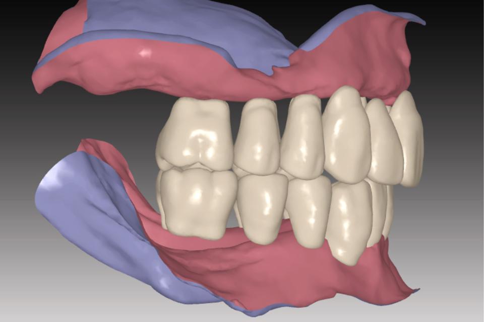 Fig. 14: Checking the denture teeth set-up in the 3D preview software (screenshot)