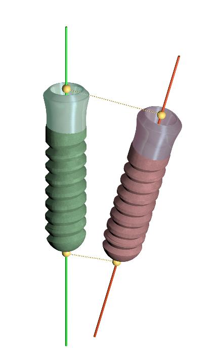 Fig. 1: Schematic illustration of planned implant (green) and inserted implant (red)