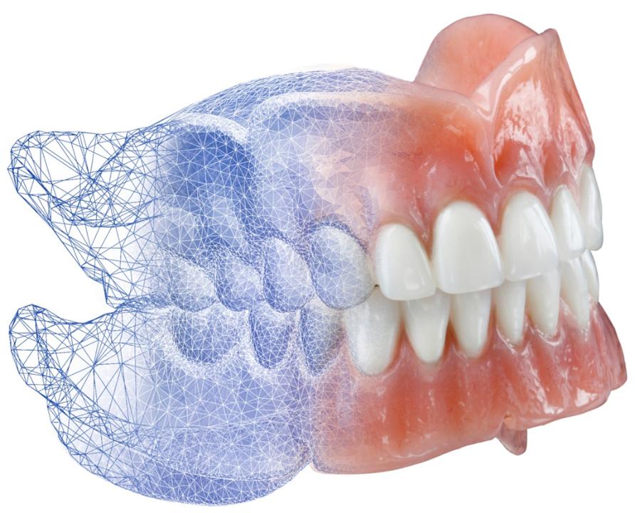 Fig. 9: An example of a digitally designed and fabricated removable complete denture (Avadent™, Global Dental Science LLC, Scottsdale, Arizona, USA)