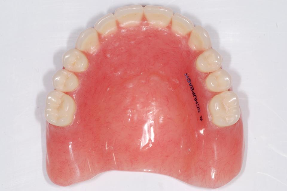Fig. 15: Maxillary denture with laser marking of the patient name