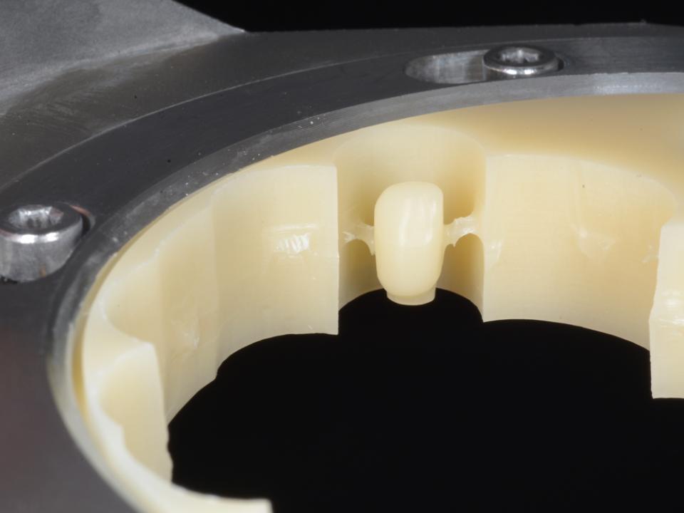Fig. 2a: Fabricação subtrativa de coroa provisória de implante (imagem cortesia of Dr. Yukihiro Takeda e TPD Kenta Matsuda)