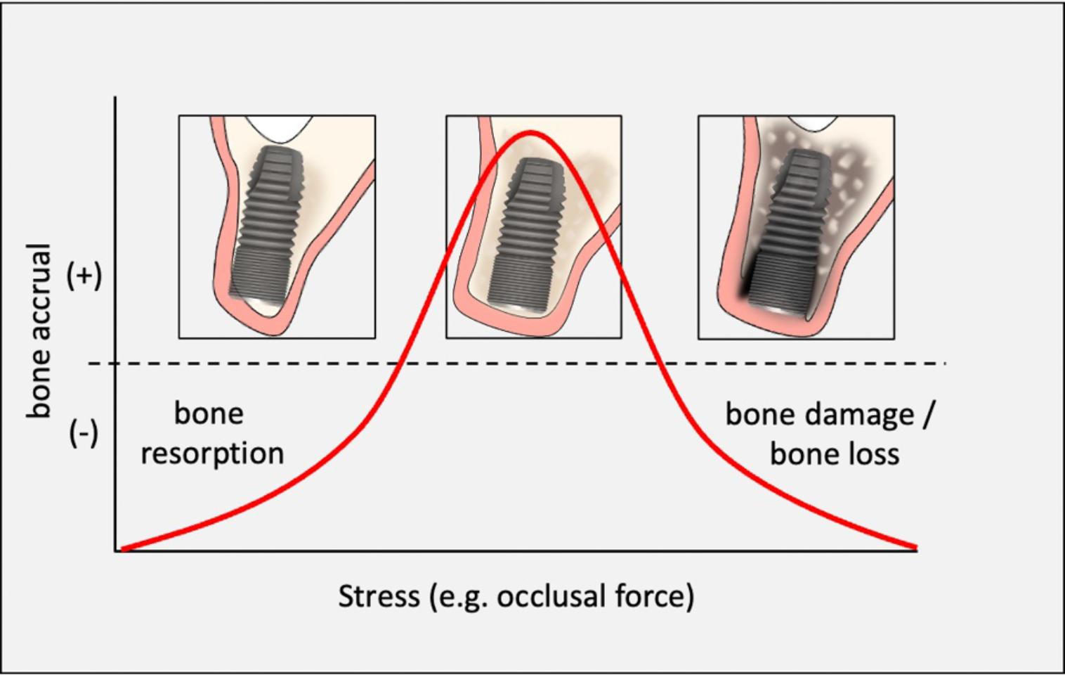 Articles Forum Implantologicum ITI