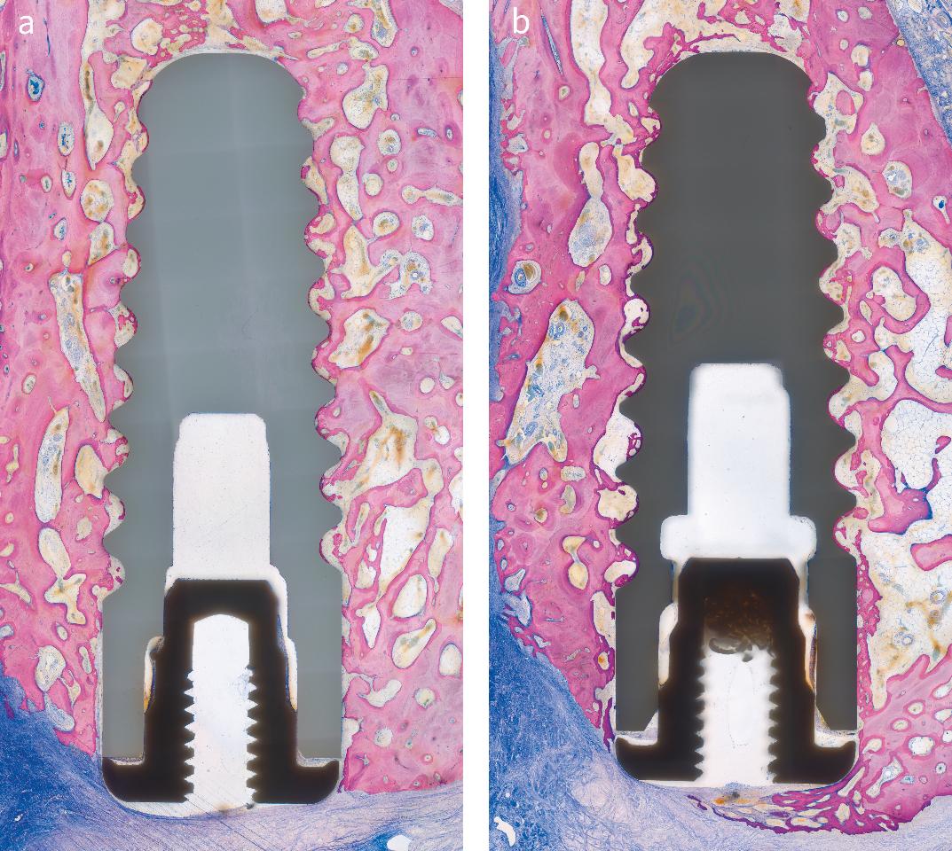 Articles - Forum Implantologicum - ITI