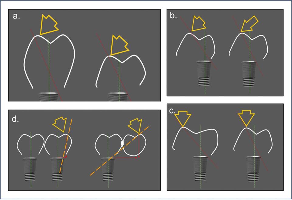 Articles Forum Implantologicum ITI