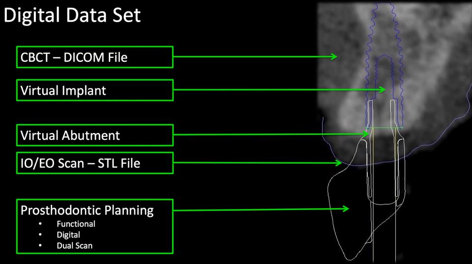 Fig. 4: Conjunto de datos digitales para la planificación de prótesis sobre implantes en el área estética