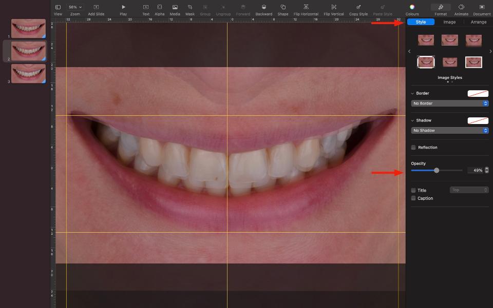 Fig. 5: Aumentando a opacidade para sobrepor a foto antes e depois