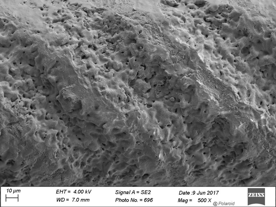 Fig 9: Detailed magnification of Fig. 5a showing the texturized surface at a crest (Zirkolith Z5m implant). Laser treatment has modified the zirconia. Note the presence of regularly spaced grooves (magnification 500x)