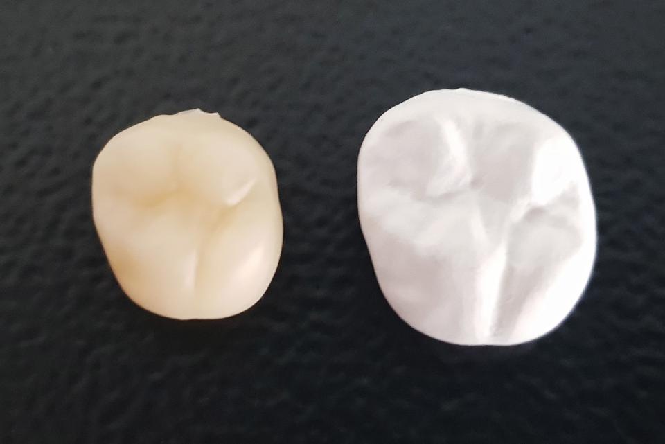 图. 5: 同一牙冠，白坯烧结前后的体积差异