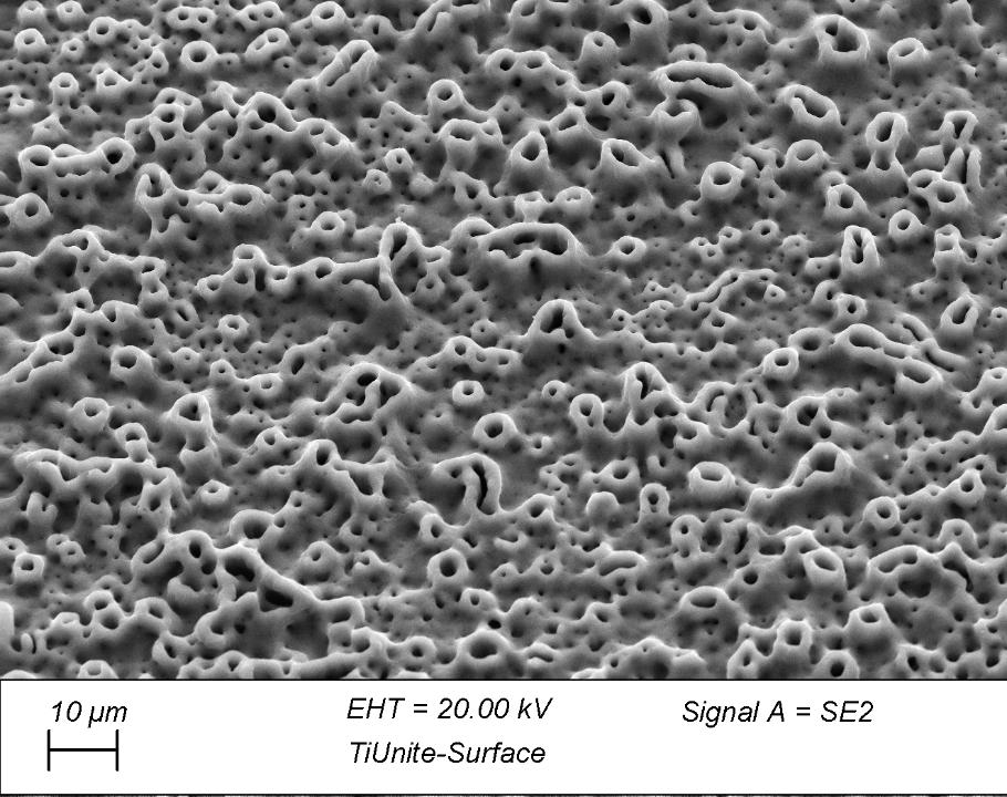 Fig. 11: Scanning electron micrograph of a titanium TiUnite® implant with a surface produced by electrochemical anodization (kindly provided by Insititut Straumann AG, Basel, Switzerland)