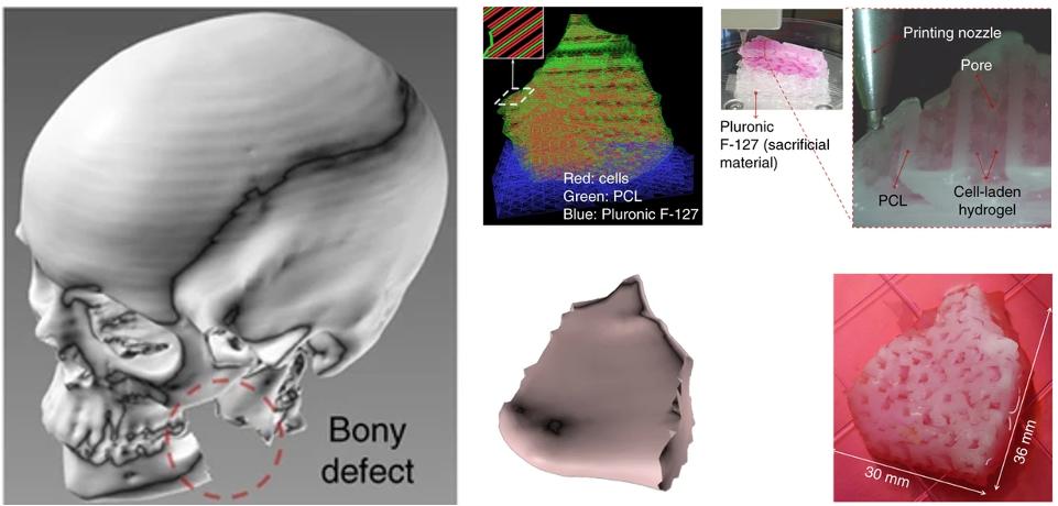 图4: 生物打印下颌（骨）结构（经Kang et al. 2016许可改编）