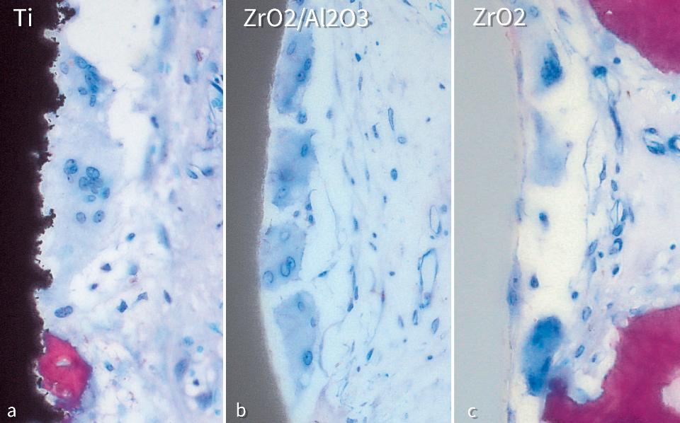 Fig. 8: Multinucleated giant cells (arrows) in contact with (A) titanium (Ti), (B) alumina-toughened zirconia (ZrO₂/Al₂O₃), and (C) zirconia (ZrO₂) implants after 4 weeks of healing (from Chappuis et al. 2016 with permission)
