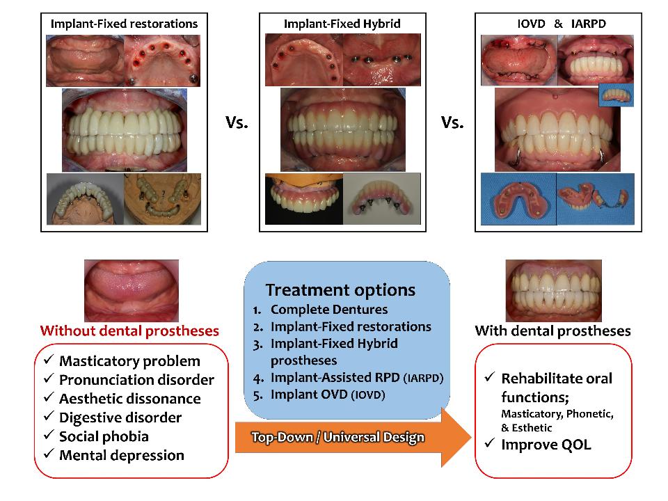 Fig. 1: Opciones de tratamiento prostodóncico para pacientes discapacitados de edad avanzada. En el caso de los pacientes discapacitados de edad avanzada, la mayoría sufren diversos trastornos de la función oral debido a la falta de muchos dientes y no a los defectos de uno o dos dientes. Es deseable proceder con el tratamiento de acuerdo con el llamado concepto top-down (Leesungbok, 2004)/restauración impulsada (Garber & Belser, 2016), que toma la prótesis final de la etapa de planificación del tratamiento y luego comienza el tratamiento. La elección de la opción de tratamiento se basa en el diseño universal (Leesungbok, 2016); es importante elegir el método más fácil para el paciente en función de su grado de discapacidad y permitirle masticar inmediatamente desde el inicio del tratamiento
