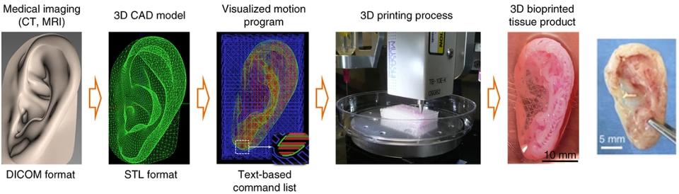 图3: 生物打印耳廓（软骨）结构（经Kang et al. 2016许可改编）