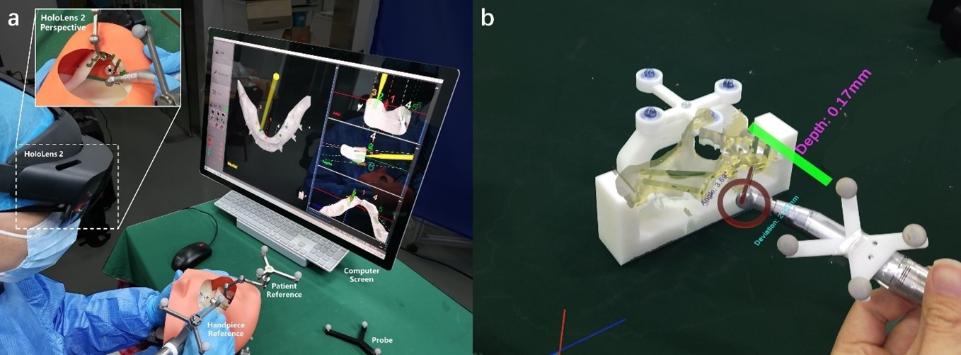 Fig. 9: The applications of an AR-based dynamic navigation system developed by Fan et al. (2023) for guiding the placement of regular dental implants (a) and zygomatic implants (b)