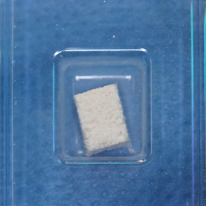 Fig. 8d: Preservación de la cresta. Material sustitutivo óseo xenogénico que contiene colágeno