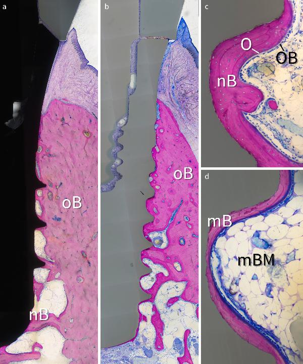 Fig. 2: Osseointegration of a titanium (A) and zirconia (B) implant after 6 weeks of healing and 4 weeks of loading in the canine mandible. Old bone (oB) and newly formed bone (nB) can be seen. Higher magnification shows bone apposition and an absence of multinucleated giant cells on the zirconia implant surface. A thick layer of newly formed bone (nB), osteoid (O), and osteoblasts (OB) is visible after 4 weeks of loading (C), whereas mature bone (mB) and bone marrow (mBM) indicate full maturation after 16 weeks of loading (D) (from Janner et al. 2017 with permission)