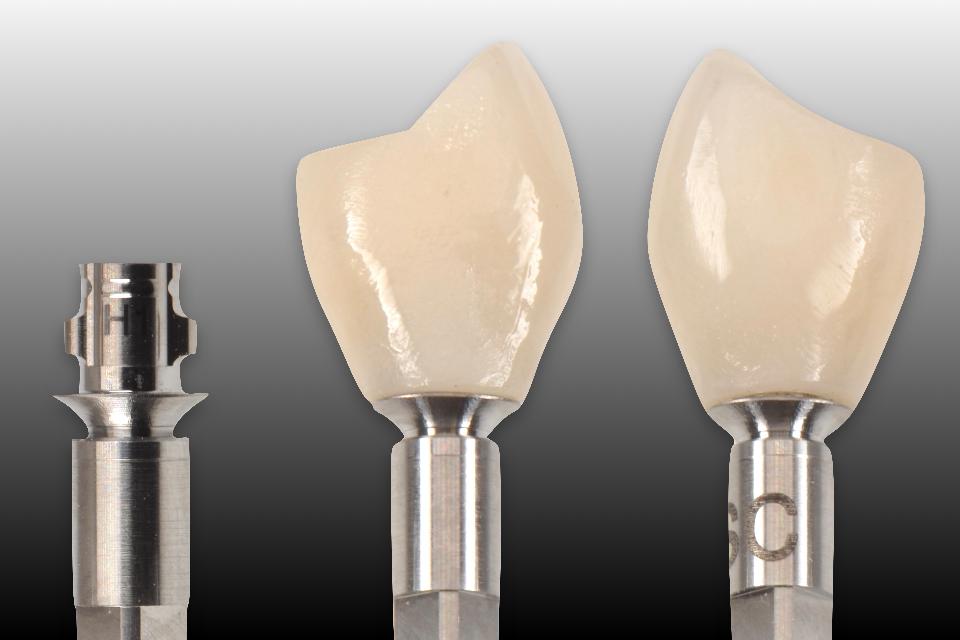 Fig. 44: Milled zirconia crowns can be completed with surface finishing, polishing and characterization. Resin luting agent is used to lute the zirconia crowns and the titanium base abutments together prior to insertion
