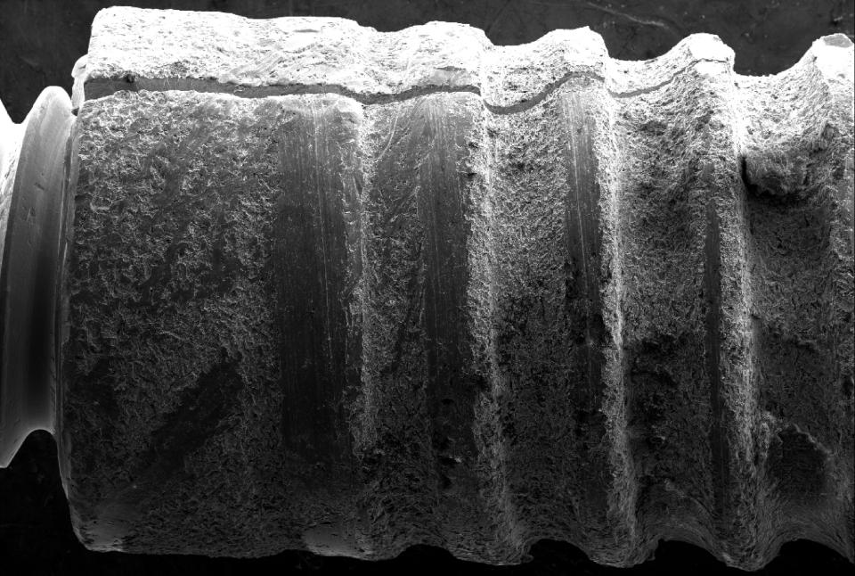 Fig. 6c: A análise de microscopia eletrônica de varredure (MEV) do implante explantado revela uma fratura devido ao desajuste em vez de fadiga 