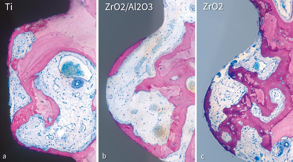 Fig. 4: Higher magnifications of osseointegrated (A) titanium (Ti), (B) alumina-toughened zirconia (ZrO₂/Al₂O₃), and (C) zirconia (ZrO₂) implants after 4 weeks of healing and tissue integration in the maxilla of a miniature pig. Both new and old bone are present on and adjacent to the implants (from Chappuis et al. 2016 with permission)