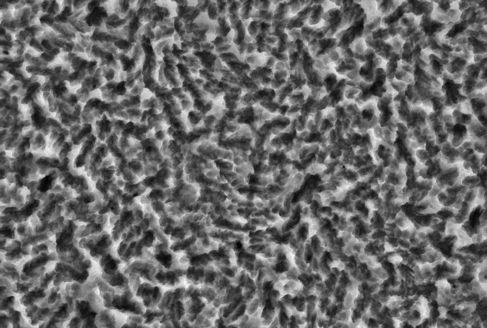 Fig. 4: Scanning electron micrograph showing a titanium implant surface morphology using acid-etching (kindly provided by Insititut Straumann AG, Basel, Switzerland)