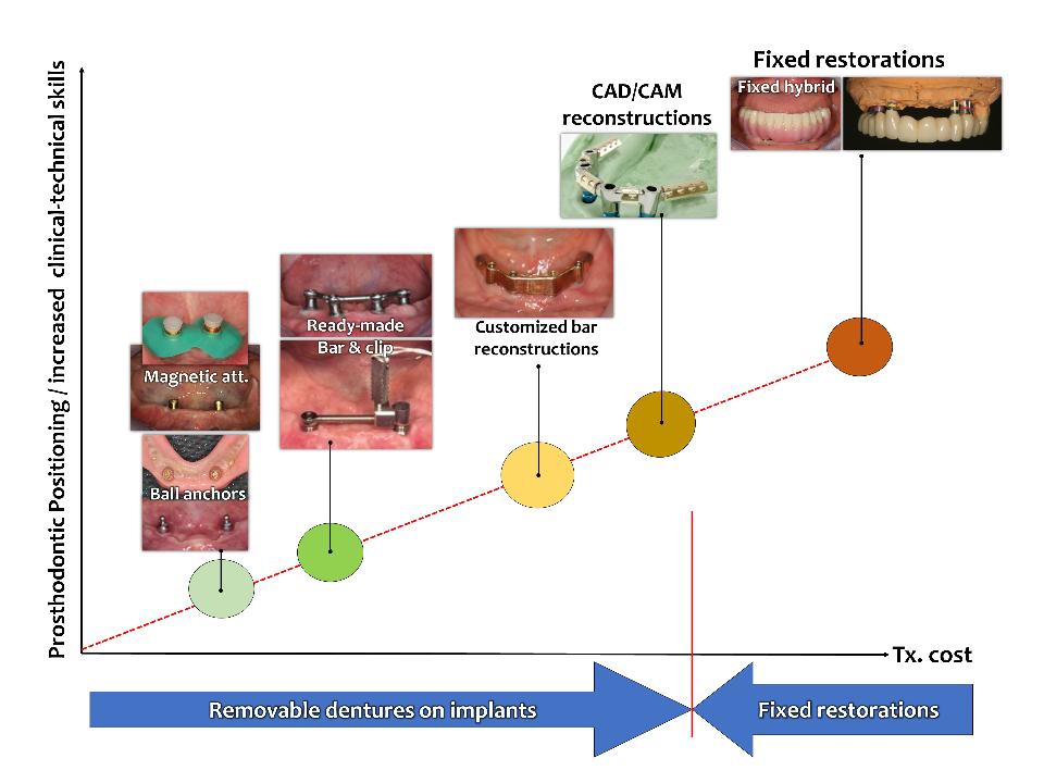 Fig. 18: Positioning in the field of reconstruction on implants. The patient has a lot of possibilities, some fixed-type reconstructions are expensive, surgically challenging and take therefore a lot of time. On the other side, the ball reconstruction is one of the cheapest possibilities for a denture on implants. The results are mostly good, but sometimes maintenance is costly. One of the conventional treatments using bar reconstructions on implants was effected more than 40 years ago. Many studies exist and we have clinical evidence on the bar structure and also a good fit for a removable denture. But the procedure in the laboratory is complex and requires a well-trained dental technician. However, for elderly people with disabilities who do not use their hands or fingers well, such removable denture prostheses are not recommended unless there is always a caregiver on hand, and if possible, any implant-retained fixed prosthesis would be a better choice as the 1st priority in treatment options