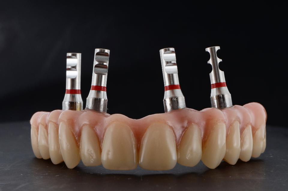 Fig 19c: The AvaDent system allows a complete denture to be transformed into a fixed supraconstruction by means of digital duplication techniques