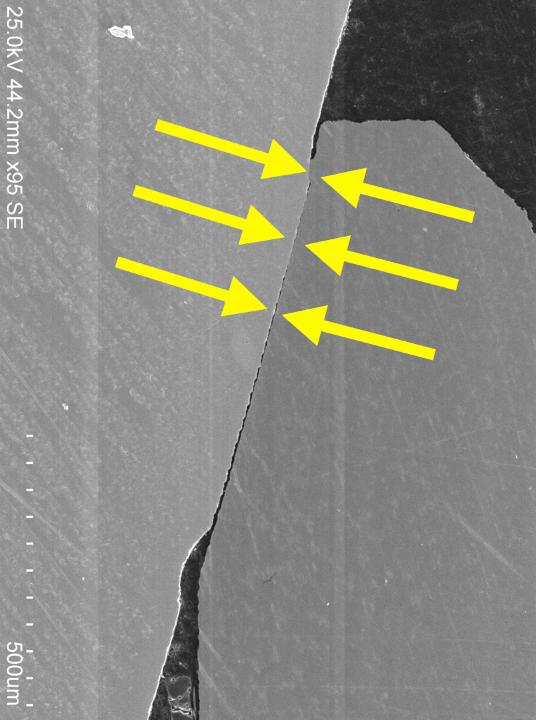 Abb. 10: Rasterelektronenmikroskopie eines schlecht passenden Implantat-Abutment-Übergangs. Da der Oberflächenkontakt nicht gleichmäßig verteilt ist, hat die Fehlpassung zur Konzentration der Belastung auf einen kleinen Bereich (gelbe Pfeile) geführt, sodass eine Ermüdungsfraktur unter funktioneller Belastung wahrscheinlicher wird.
