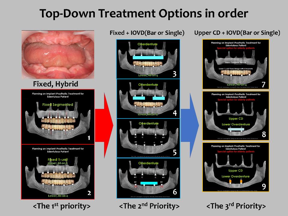 Fig. 5: Treatment options for edentulous patients. Among the treatment options proposed based on the top-down concept (Leesungbok 2004), the selection priority is for a natural tooth-like fixed implant prosthesis, and if implant surgery cannot be performed due to various factors (economic constraints, systemic health conditions that make implant surgery difficult, etc.), the maximum effect with any removable-type prostheses should be considered. It should always be remembered that there is not only one treatment option for patients, and informed consent should be completed directly with patients and their caregivers to allow them to choose the best option for the patient among several top-down treatment options. (1, 2: the 1st priority of option; 3 – 6: the 2nd priority of option; and 7~9: the 3rd priority of option)