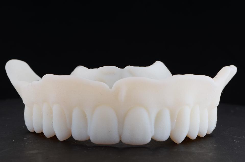 Fig 19b: The AvaDent system allows a complete denture to be transformed into a fixed supraconstruction by means of digital duplication techniques