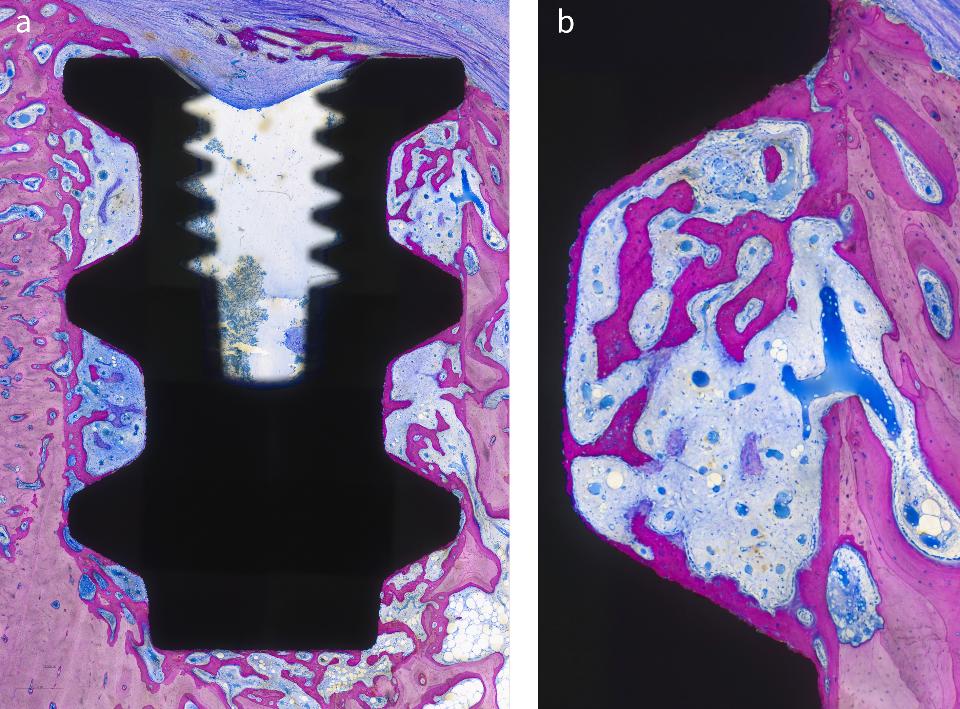 Fig. 19a-b: Low- (a) and high-magnification (b) micrographs of an ultrafine-grained titanium implant in the mandible of a miniature pig 8 weeks after installation. Note the excellent bone-to-implant contact (from Chappuis et al. 2018 with permission)
