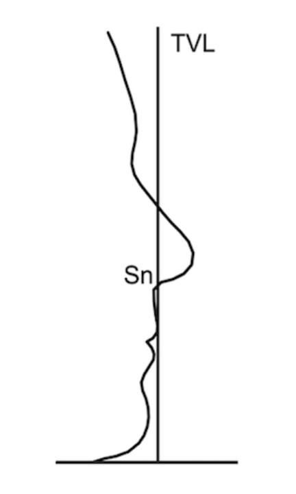 Fig. 2: Linha vertical verdadeira como linha de referência para medições lineares e angulares que descrevem o perfil dos tecidos moles (republicado de http://urn.fi/urn:isbn:9789526231945 após permissão do autor)