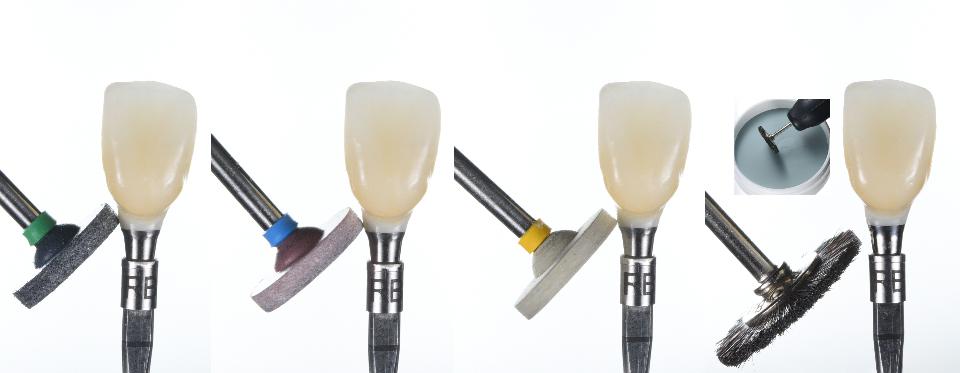 Fig. 9: It must be noted that “high-polished” zirconia shows better soft tissue attachment than glazed or rough surfaces. If ceramic glaze or other restorative materials are considered, it is recommended to place these materials submucosally as coronally as possible