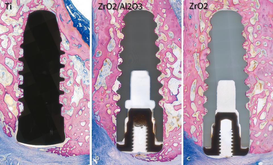 Fig. 3: Osseointegrated (A) titanium (Ti), (B) alumina-toughened zirconia (ZrO₂/Al₂O₃), and (C) zirconia (ZrO₂) implants after 4 weeks of healing and tissue integration in a miniature pig maxilla (from Chappuis et al. 2016 with permission)